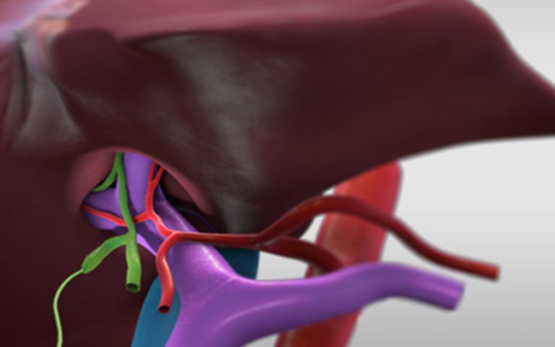 Чернодробна трансплантация: Лява латерална хепатектомия при жив донор (донор)
